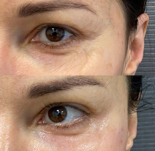 juvelook-pore-tightening-collagen-booster