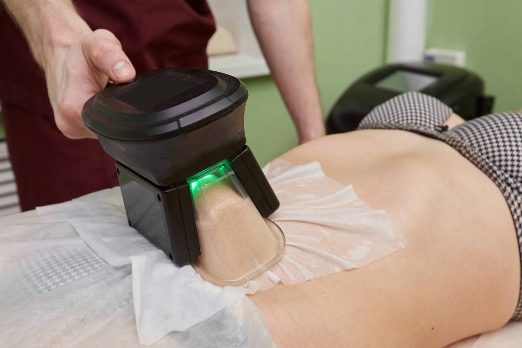 Cryolipolysis fat freezing treatment at Lifeshots Healthcare in Hiranandani Estate, Thane